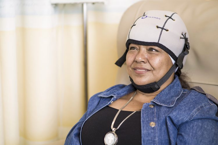 UPMC Hillman Cancer Center offers treatment to reduce chemo hair loss